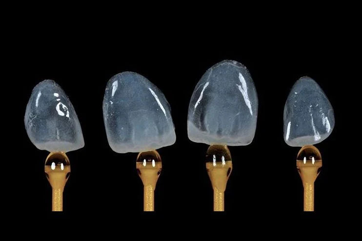 Mặt dán sứ Veneer