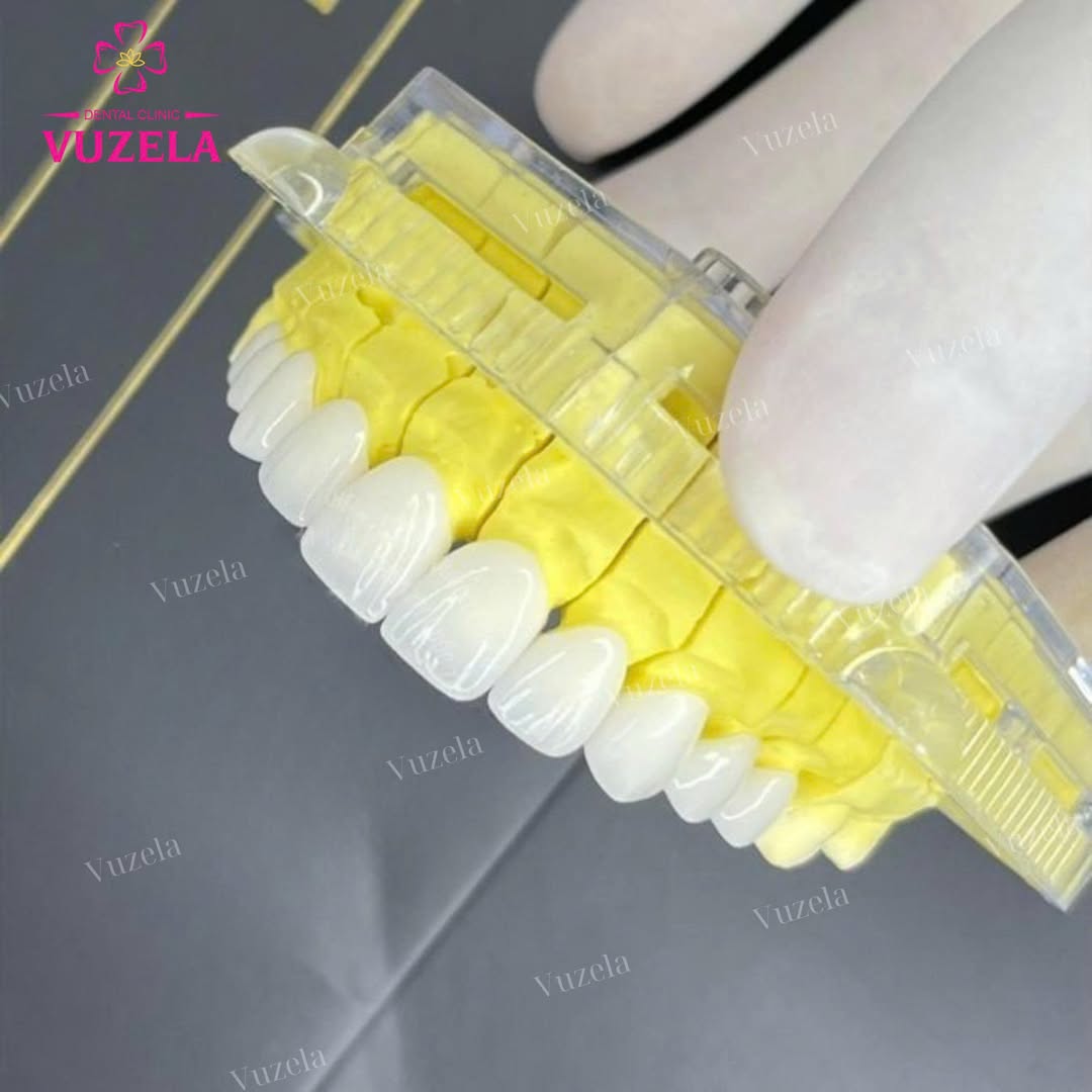 Bọc răng sứ thẩm mỹ