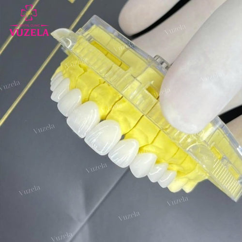 Bọc răng sứ thẩm mỹ