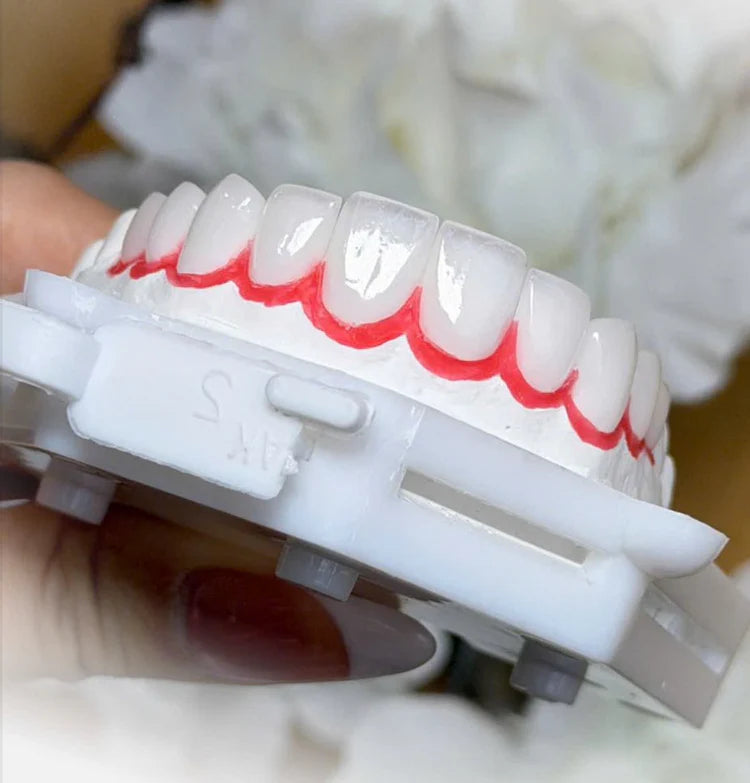 Bọc răng sứ thẩm mỹ