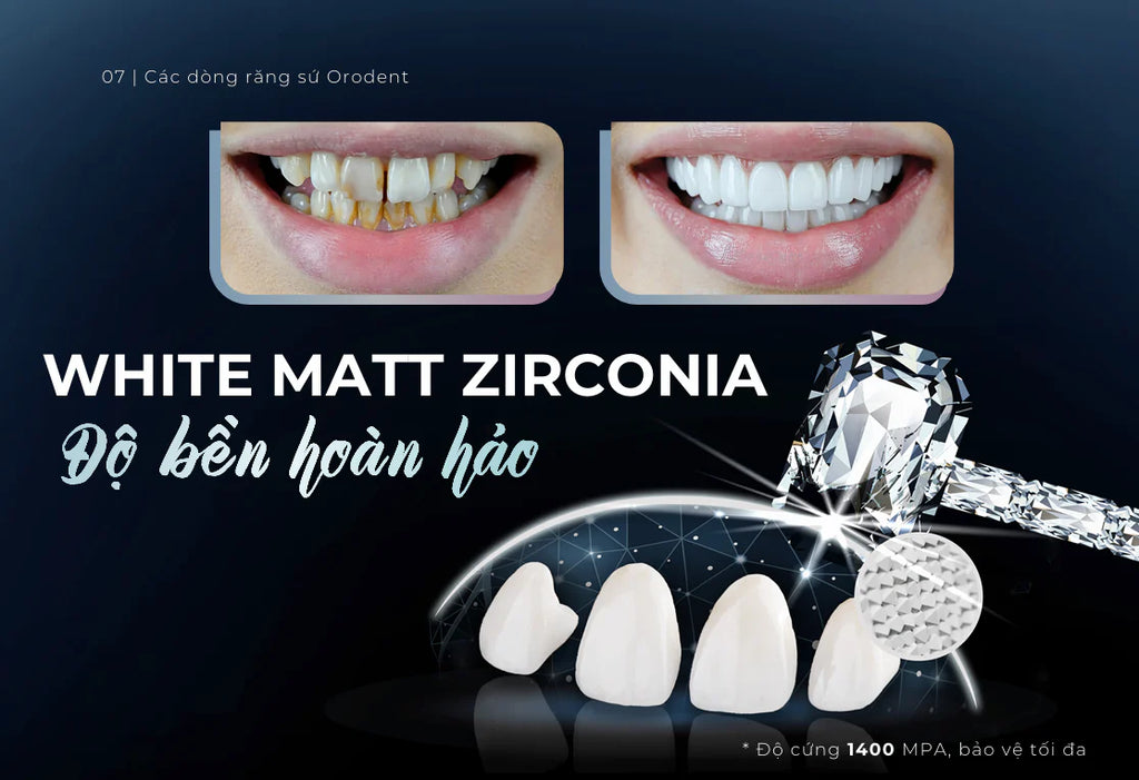 Răng Sứ Cao Cấp ORODENT