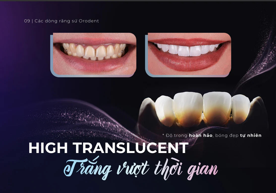 Răng Sứ Cao Cấp ORODENT
