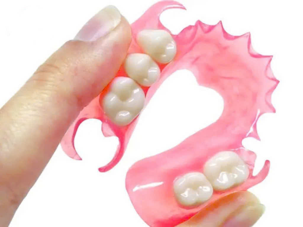 Hàm tháo lắp nền dẻo